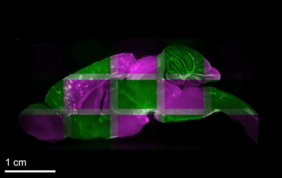 A light-sheet microscope imaging an expanded whole mouse brain tile by tile